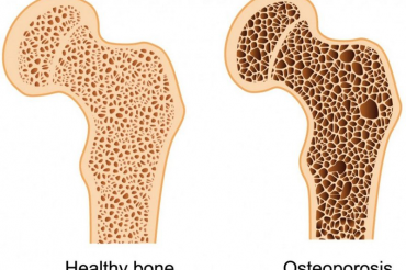 Related course image