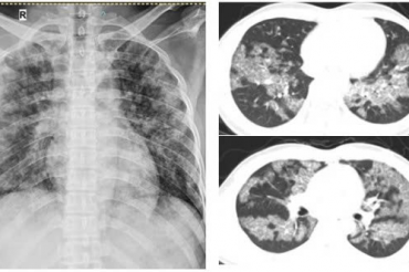 Related course image