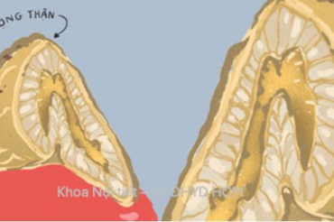 Related course image